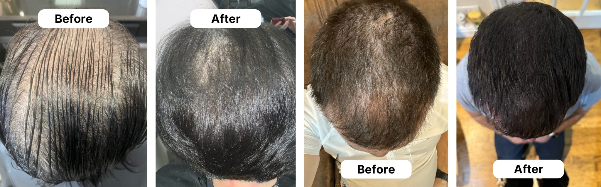 HUSSSH® hair recovery — before and after results