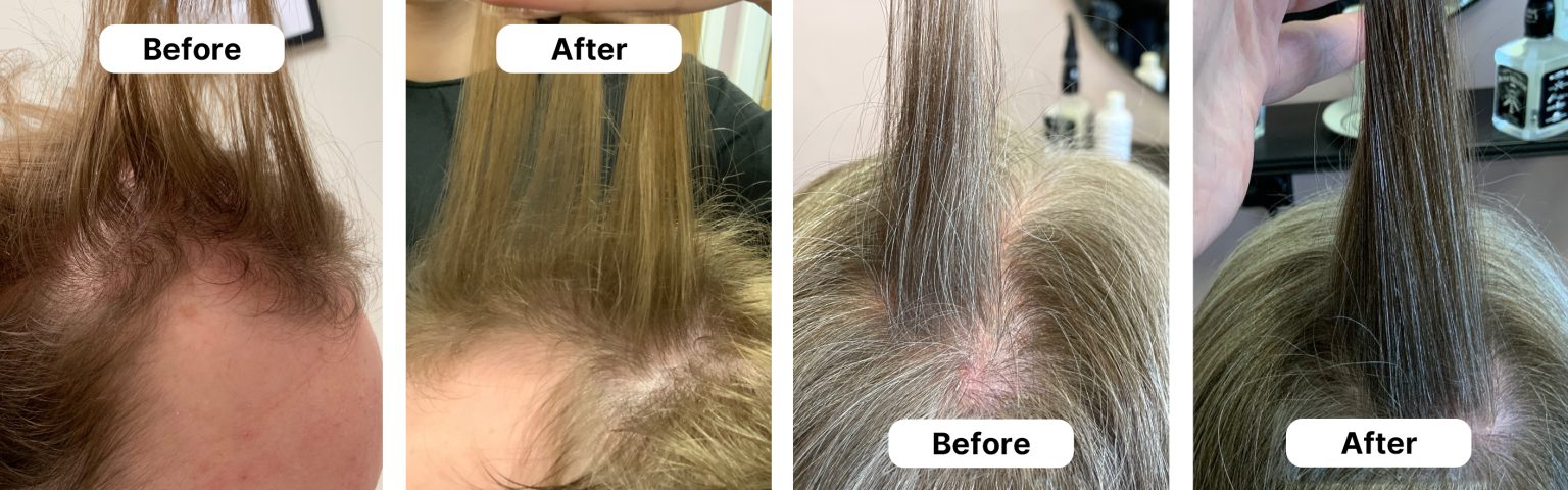 HUSSSH® hair recovery — before and after results