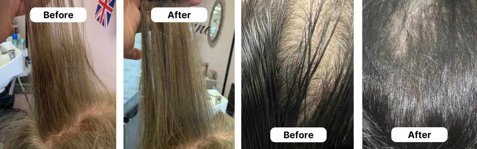 HUSSSH® hair recovery — before and after results